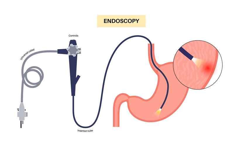 Best Endoscopy surgeon